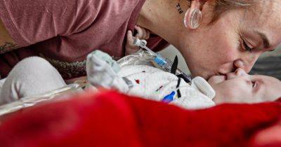 ‘A Chance to Live’: How 2 Families Faced a Catastrophic Birth Defect