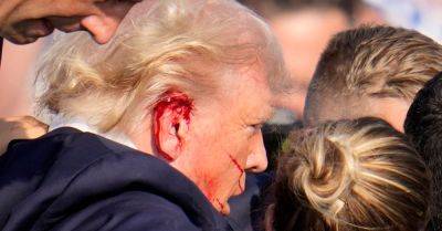FBI Says Trump Was Indeed Struck By Bullet During Assassination Attempt