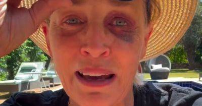 Marco Margaritoff - Sharon Stone Shows Off Shiner To Reassure Concerned Fans: 'I Know You're All Worried' - huffpost.com - Turkey - county Stone - city Sharon, county Stone