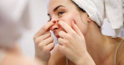 Here’s Why You Should Never Pop A Pimple On Your Nose